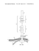 CHANNEL SEPARATION DEVICE AND RELATED METHOD THEREOF diagram and image