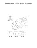 IRRIGATED FLEXIBLE ABLATION CATHETER diagram and image