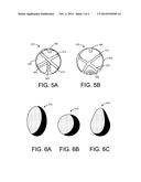 LOW VOLUME INTRAGASTRIC DEVICE diagram and image