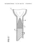 Neuroaneurysm occlusion and delivery device and method of using same diagram and image