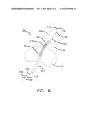 DEVICES AND SYSTEMS FOR INVERTING AND CLOSING THE LEFT ATRIAL APPENDAGE diagram and image