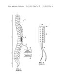 APPARATUS AND METHOD USING NEAR INFRARED REFLECTOMETRY TO REDUCE THE     EFFECT OF POSITIONAL CHANGES DURING SPINAL CORD STIMULATION diagram and image