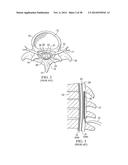 APPARATUS AND METHOD USING NEAR INFRARED REFLECTOMETRY TO REDUCE THE     EFFECT OF POSITIONAL CHANGES DURING SPINAL CORD STIMULATION diagram and image