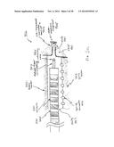 APPARATUS AND METHOD USING NEAR INFRARED REFLECTOMETRY TO REDUCE THE     EFFECT OF POSITIONAL CHANGES DURING SPINAL CORD STIMULATION diagram and image