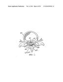 APPARATUS AND METHOD USING NEAR INFRARED REFLECTOMETRY TO REDUCE THE     EFFECT OF POSITIONAL CHANGES DURING SPINAL CORD STIMULATION diagram and image