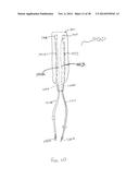 APPARATUS AND METHOD USING NEAR INFRARED REFLECTOMETRY TO REDUCE THE     EFFECT OF POSITIONAL CHANGES DURING SPINAL CORD STIMULATION diagram and image