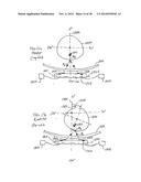 APPARATUS AND METHOD USING NEAR INFRARED REFLECTOMETRY TO REDUCE THE     EFFECT OF POSITIONAL CHANGES DURING SPINAL CORD STIMULATION diagram and image