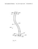 APPARATUS AND METHOD USING NEAR INFRARED REFLECTOMETRY TO REDUCE THE     EFFECT OF POSITIONAL CHANGES DURING SPINAL CORD STIMULATION diagram and image