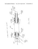 APPARATUS AND METHOD USING NEAR INFRARED REFLECTOMETRY TO REDUCE THE     EFFECT OF POSITIONAL CHANGES DURING SPINAL CORD STIMULATION diagram and image