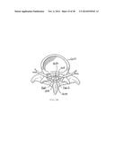 APPARATUS AND METHOD USING NEAR INFRARED REFLECTOMETRY TO REDUCE THE     EFFECT OF POSITIONAL CHANGES DURING SPINAL CORD STIMULATION diagram and image