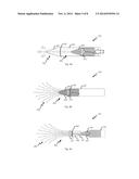 MULTI-BRANCH STIMULATION ELECTRODE FOR SUBCUTANEOUS FIELD STIMULATION diagram and image