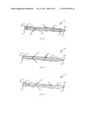 MULTI-BRANCH STIMULATION ELECTRODE FOR SUBCUTANEOUS FIELD STIMULATION diagram and image