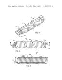 IMPLANTABLE LEAD HAVING MULTI-PLANAR SPIRAL INDUCTOR FILTER diagram and image