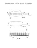 IMPLANTABLE LEAD HAVING MULTI-PLANAR SPIRAL INDUCTOR FILTER diagram and image