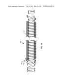 IMPLANTABLE LEAD HAVING MULTI-PLANAR SPIRAL INDUCTOR FILTER diagram and image