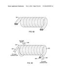 IMPLANTABLE LEAD HAVING MULTI-PLANAR SPIRAL INDUCTOR FILTER diagram and image