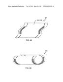 IMPLANTABLE LEAD HAVING MULTI-PLANAR SPIRAL INDUCTOR FILTER diagram and image