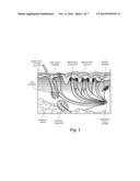 SYSTEMS AND METHODS FOR THE TREATMENT OF PAIN THROUGH NEURAL FIBER     STIMULATION diagram and image