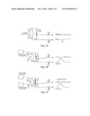 SYSTEMS AND METHODS FOR THE TREATMENT OF PAIN THROUGH NEURAL FIBER     STIMULATION diagram and image