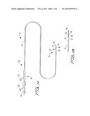 GUIDEWIRE LOADED STENT FOR DELIVERY THROUGH A CATHETER diagram and image