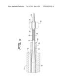 GUIDEWIRE LOADED STENT FOR DELIVERY THROUGH A CATHETER diagram and image