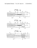 GUIDEWIRE LOADED STENT FOR DELIVERY THROUGH A CATHETER diagram and image