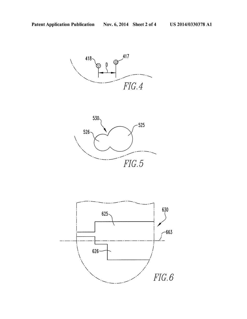 DOUBLE-LOOP ENDOBUTTON, OVOID TUNNEL GUIDE, AND METHOD OF ACL     RE-CONSTRUCTION USING THE OVOID TUNNEL GUIDE AND THE DOUBLE-LOOP     ENDOBUTTON - diagram, schematic, and image 03