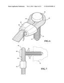 CLAMPING ASSEMBLIES FOR SECURING LIGAMENTS TO A BONE diagram and image