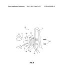 ARTIFICIAL SI JOINT diagram and image