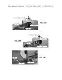 SYSTEMS AND METHODS FOR SAFE COMPLIANT INSERTION AND HYBRID FORCE/MOTION     TELEMANIPULATION OF CONTINUUM ROBOTS diagram and image