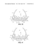 FOOTWEAR SOLES INCLUDING AN ELECTRONIC CONTROL SYSTEM CONTROLLINING THE     FLOW RESISTANCE OF A MAGNETORHEOLOGICAL FLUID IN COMPARTMENTS WITH     INTERNAL FLEXIBILITY SIPES BETWEEN INNER AND OUTER COMPARTMENTS diagram and image