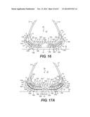 FOOTWEAR SOLES INCLUDING AN ELECTRONIC CONTROL SYSTEM CONTROLLINING THE     FLOW RESISTANCE OF A MAGNETORHEOLOGICAL FLUID IN COMPARTMENTS WITH     INTERNAL FLEXIBILITY SIPES BETWEEN INNER AND OUTER COMPARTMENTS diagram and image