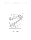 FOOTWEAR SOLES INCLUDING AN ELECTRONIC CONTROL SYSTEM CONTROLLINING THE     FLOW RESISTANCE OF A MAGNETORHEOLOGICAL FLUID IN COMPARTMENTS WITH     INTERNAL FLEXIBILITY SIPES BETWEEN INNER AND OUTER COMPARTMENTS diagram and image