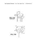 FOOTWEAR SOLES INCLUDING AN ELECTRONIC CONTROL SYSTEM CONTROLLINING THE     FLOW RESISTANCE OF A MAGNETORHEOLOGICAL FLUID IN COMPARTMENTS WITH     INTERNAL FLEXIBILITY SIPES BETWEEN INNER AND OUTER COMPARTMENTS diagram and image