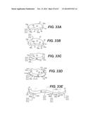 FOOTWEAR SOLES INCLUDING AN ELECTRONIC CONTROL SYSTEM CONTROLLINING THE     FLOW RESISTANCE OF A MAGNETORHEOLOGICAL FLUID IN COMPARTMENTS WITH     INTERNAL FLEXIBILITY SIPES BETWEEN INNER AND OUTER COMPARTMENTS diagram and image