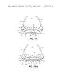 FOOTWEAR SOLES INCLUDING AN ELECTRONIC CONTROL SYSTEM CONTROLLINING THE     FLOW RESISTANCE OF A MAGNETORHEOLOGICAL FLUID IN COMPARTMENTS WITH     INTERNAL FLEXIBILITY SIPES BETWEEN INNER AND OUTER COMPARTMENTS diagram and image