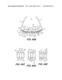 FOOTWEAR SOLES INCLUDING AN ELECTRONIC CONTROL SYSTEM CONTROLLINING THE     FLOW RESISTANCE OF A MAGNETORHEOLOGICAL FLUID IN COMPARTMENTS WITH     INTERNAL FLEXIBILITY SIPES BETWEEN INNER AND OUTER COMPARTMENTS diagram and image