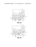 FOOTWEAR SOLES INCLUDING AN ELECTRONIC CONTROL SYSTEM CONTROLLINING THE     FLOW RESISTANCE OF A MAGNETORHEOLOGICAL FLUID IN COMPARTMENTS WITH     INTERNAL FLEXIBILITY SIPES BETWEEN INNER AND OUTER COMPARTMENTS diagram and image