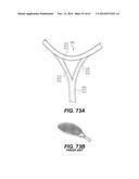 FOOTWEAR SOLES INCLUDING AN ELECTRONIC CONTROL SYSTEM CONTROLLINING THE     FLOW RESISTANCE OF A MAGNETORHEOLOGICAL FLUID IN COMPARTMENTS WITH     INTERNAL FLEXIBILITY SIPES BETWEEN INNER AND OUTER COMPARTMENTS diagram and image