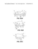 FOOTWEAR SOLES INCLUDING AN ELECTRONIC CONTROL SYSTEM CONTROLLINING THE     FLOW RESISTANCE OF A MAGNETORHEOLOGICAL FLUID IN COMPARTMENTS WITH     INTERNAL FLEXIBILITY SIPES BETWEEN INNER AND OUTER COMPARTMENTS diagram and image