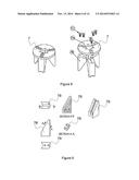 Adjustable Ratcheting Socket Tool diagram and image