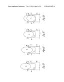 Peeling System And Peeling Machine For Peeling A Strand Of Food Product diagram and image