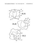 ORIFICE DISC FOR REGULATING FLOW IN DAMPER diagram and image