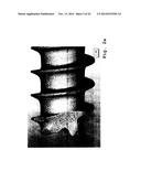 Osteosynthesis with nano-silver diagram and image