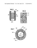 ENDOLUMINAL IMPLANTABLE SURFACES, STENTS, AND GRAFTS AND METHOD OF MAKING     THE SAME diagram and image