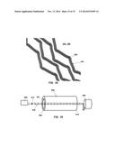 ENDOLUMINAL IMPLANTABLE SURFACES, STENTS, AND GRAFTS AND METHOD OF MAKING     THE SAME diagram and image