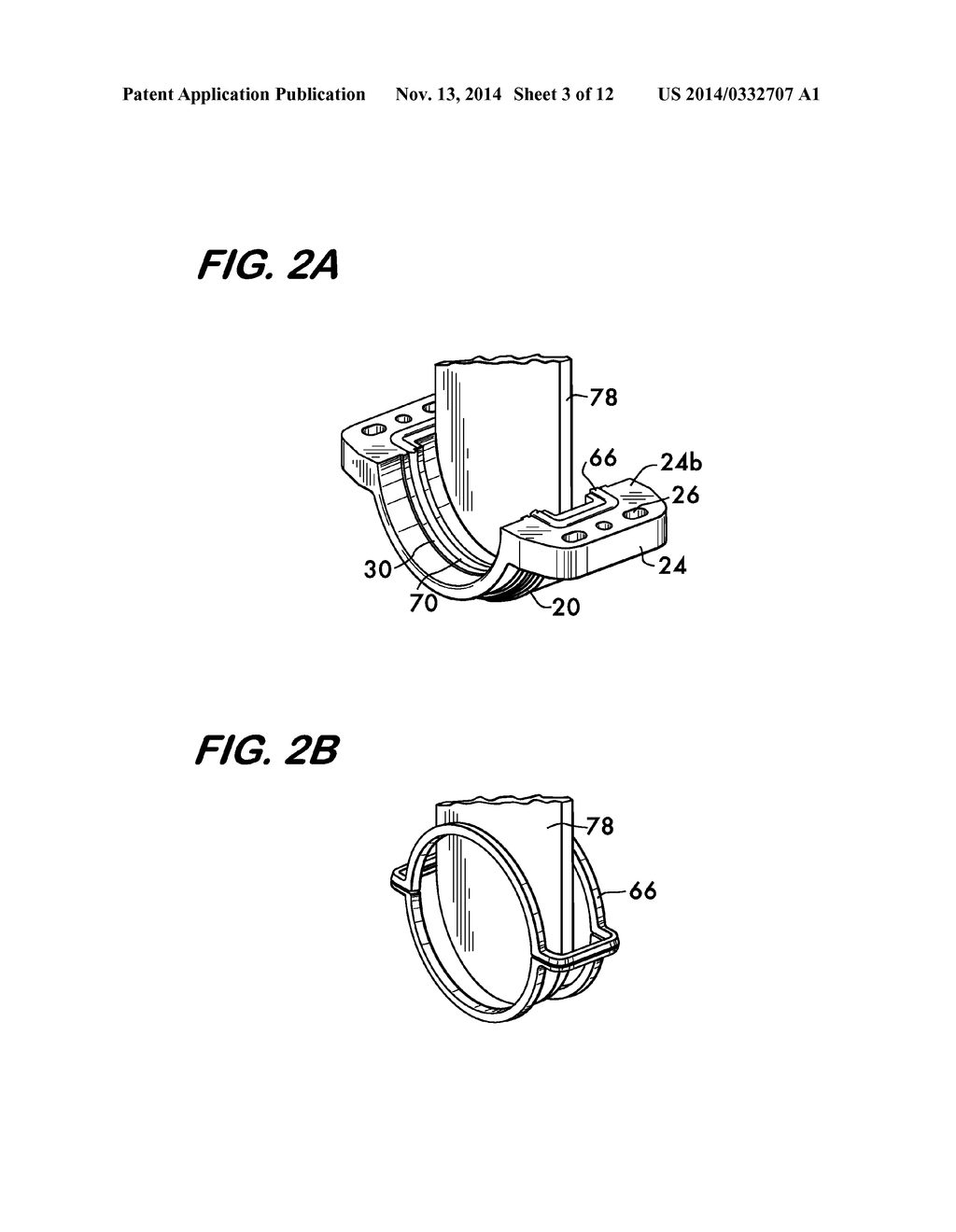 Valve With Removable Seat - diagram, schematic, and image 04