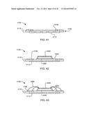 Integrated Circuit Package System with Removable Backing Element Having     Plated Terminal Leads and Method of Manufacture Thereof diagram and image