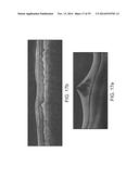 SEGMENTATION AND IDENTIFICATION OF LAYERED STRUCTURES IN IMAGES diagram and image