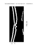 SEGMENTATION AND IDENTIFICATION OF LAYERED STRUCTURES IN IMAGES diagram and image